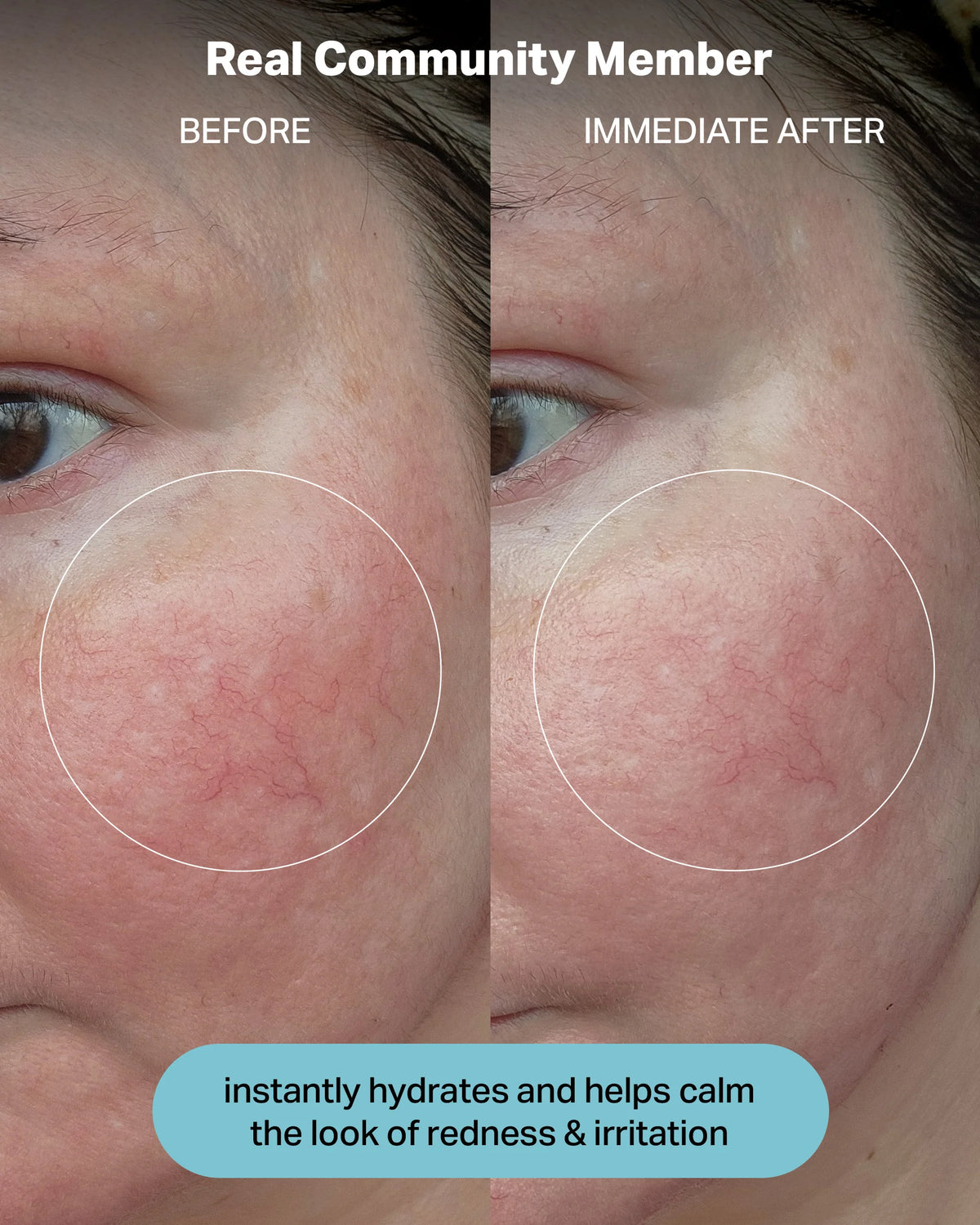 Hydrating Electrolyte Rescue Serum
