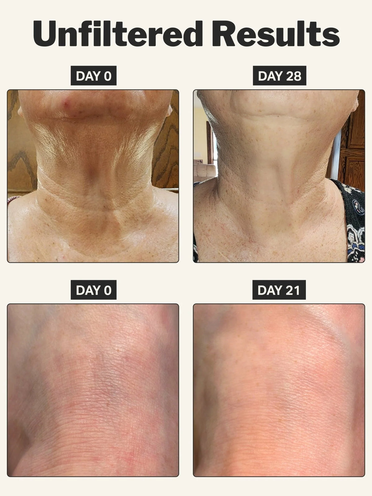retinol body cream