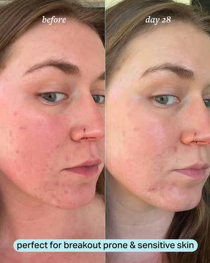 travel-size calming magnesium mist