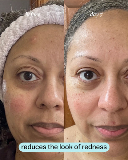 travel-size calming magnesium mist