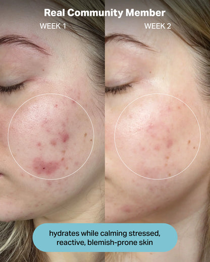 Hydrating Electrolyte Rescue Serum