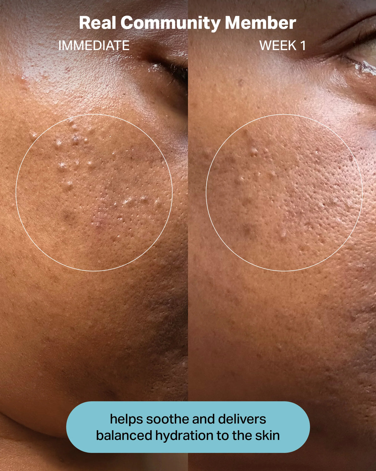 Hydrating Electrolyte Rescue Serum