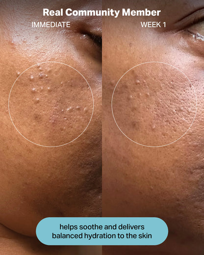 Hydrating Electrolyte Rescue Serum