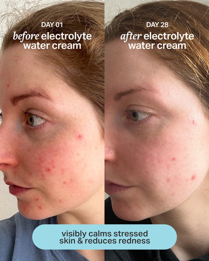 electrolyte water cream